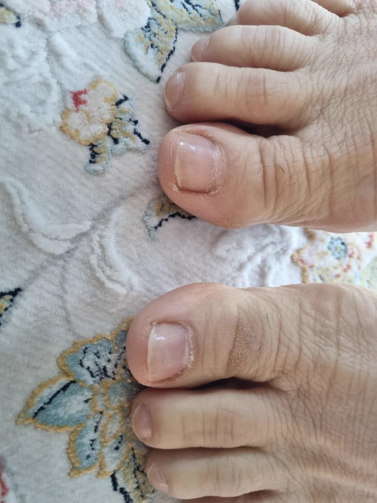 A client's feet after a foot care treatment by Alexandri in Eastbourne