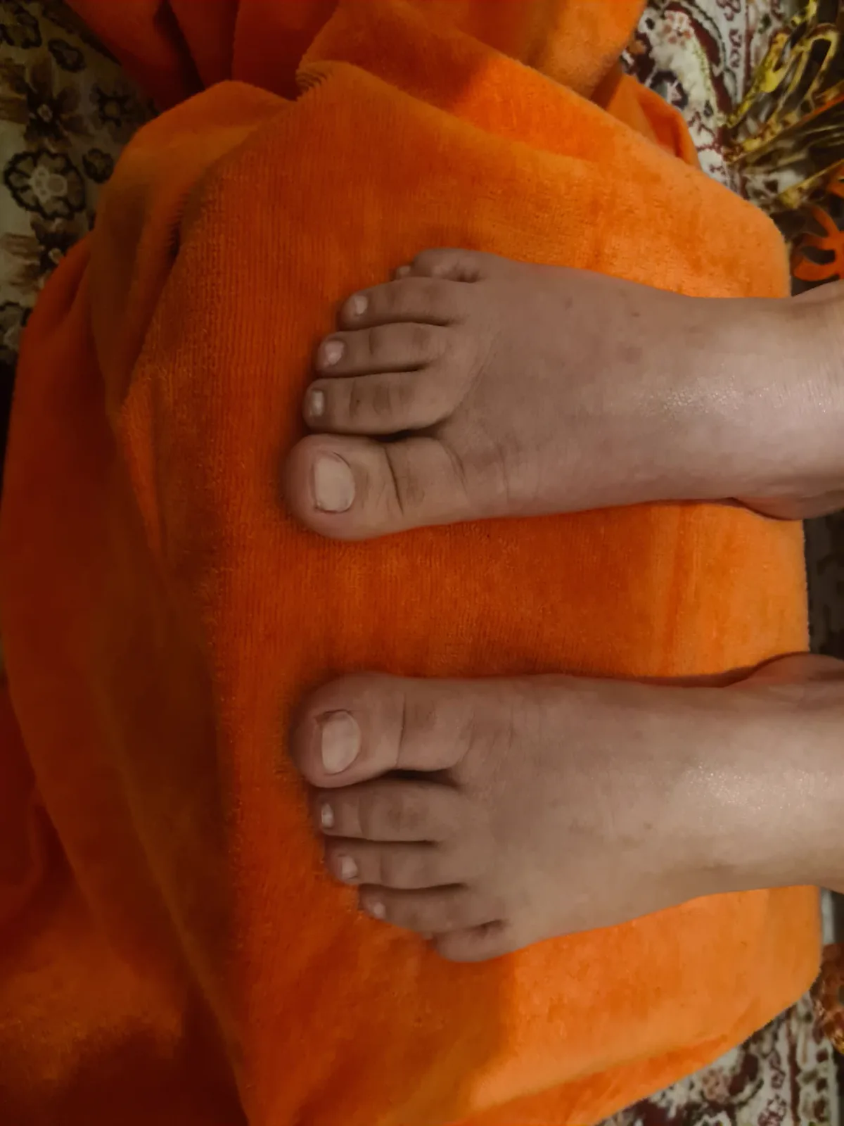 A client's feet after a foot care treatment by Alexandri in Eastbourne