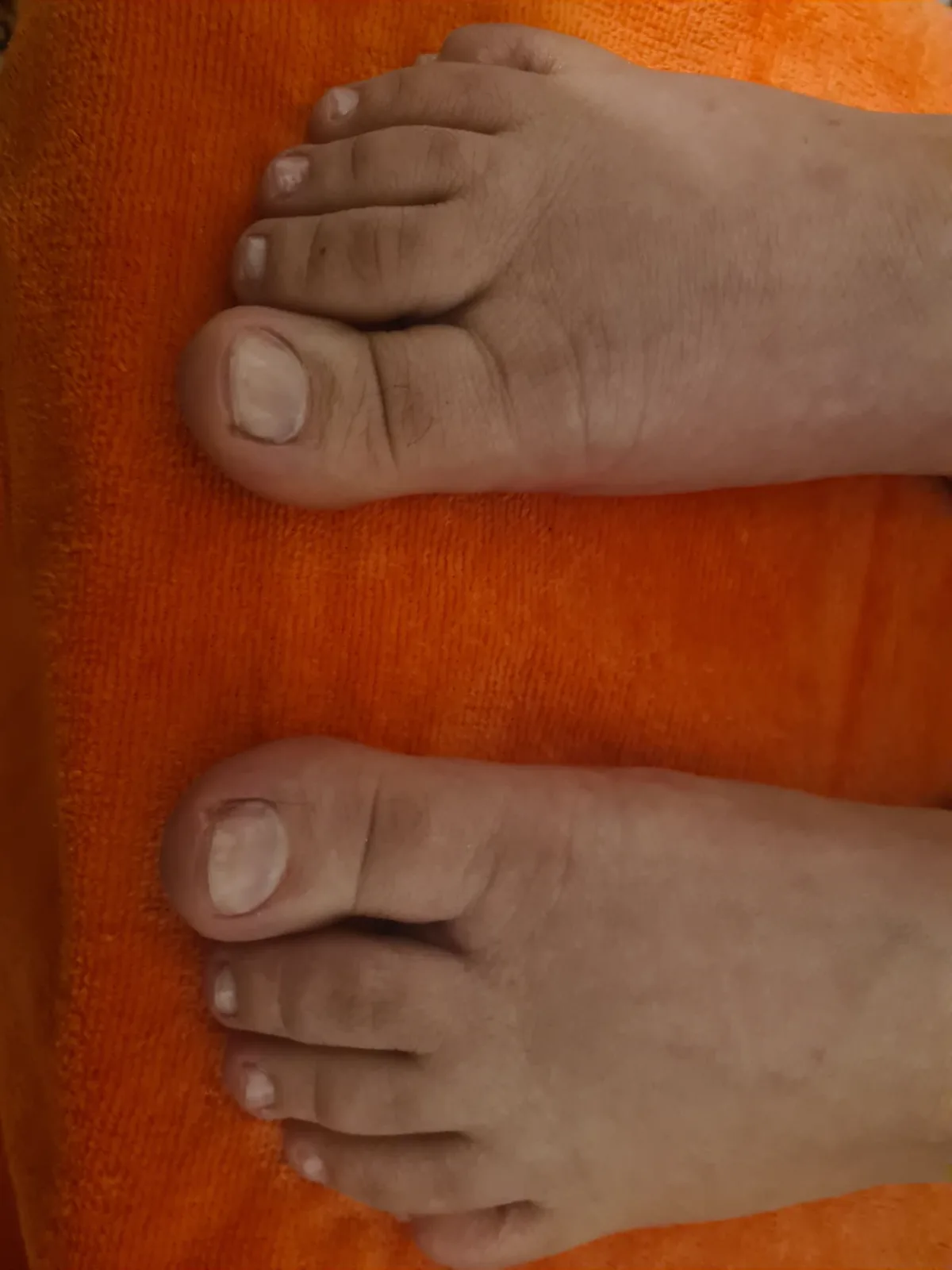 A client's feet after a foot care treatment by Alexandri in Eastbourne