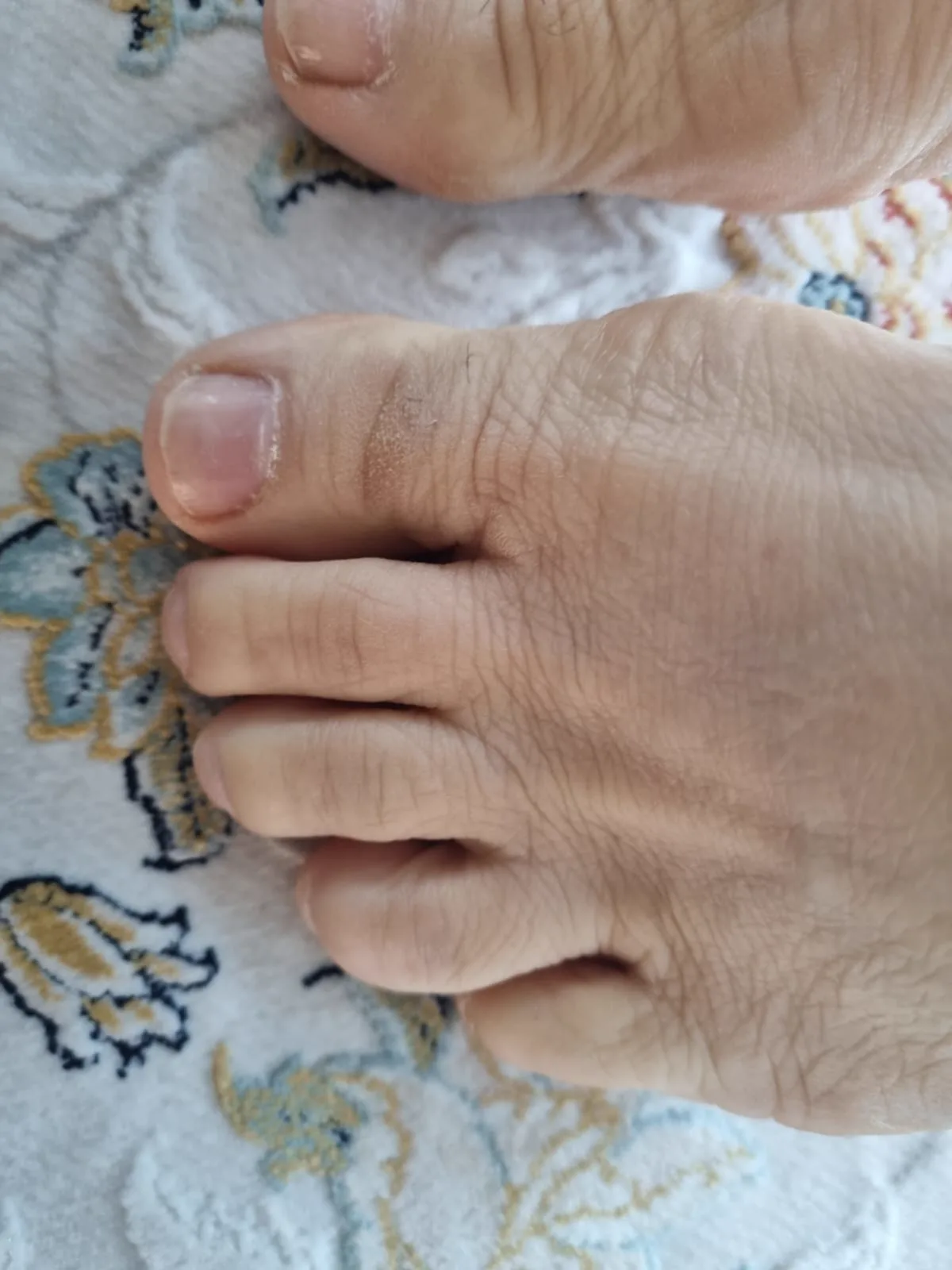 A client's feet after a foot care treatment by Alexandri in Eastbourne