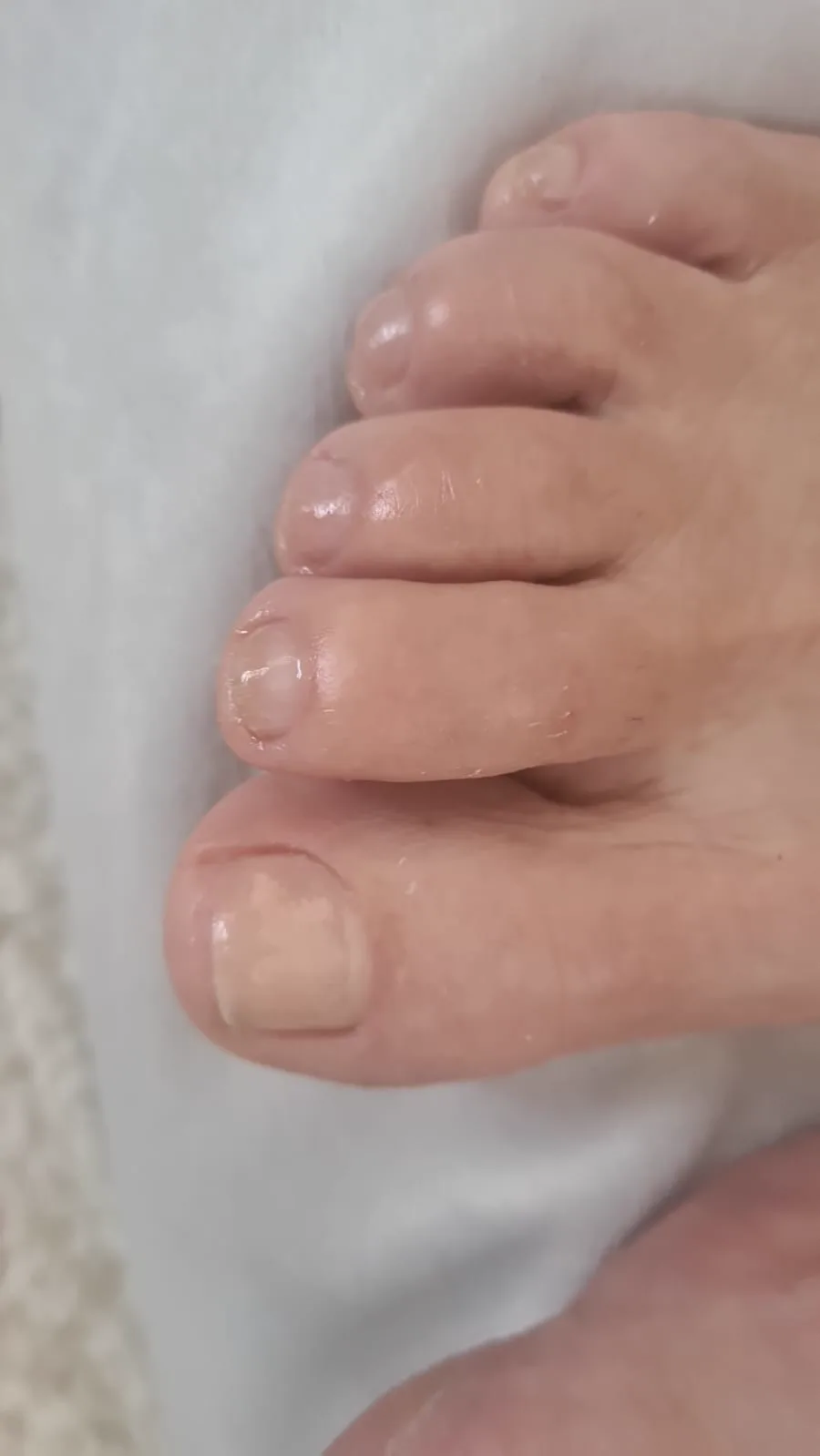 A client's feet after a foot care treatment by Alexandri in Eastbourne